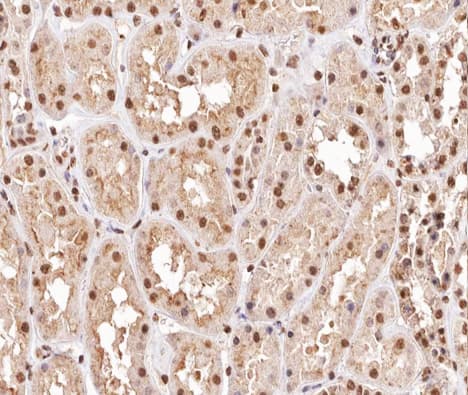 DUSP1 / MKP1 Antibody (phospho-Ser296,pSer318)