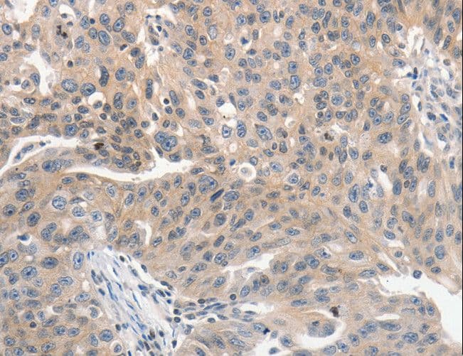 PRKD1 / PKC Mu Antibody