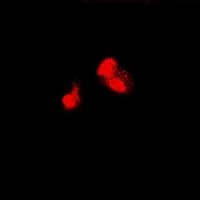 Polyclonal Rabbit anti-Human SIAH1 Antibody (IF, WB)