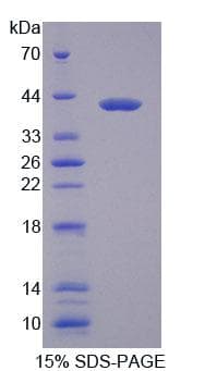 Mouse MYH1 Protein (Recombinant His-GST)