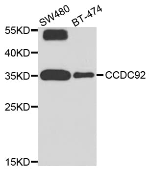 Polyclonal Rabbit anti-Human CCDC92 Antibody (WB)