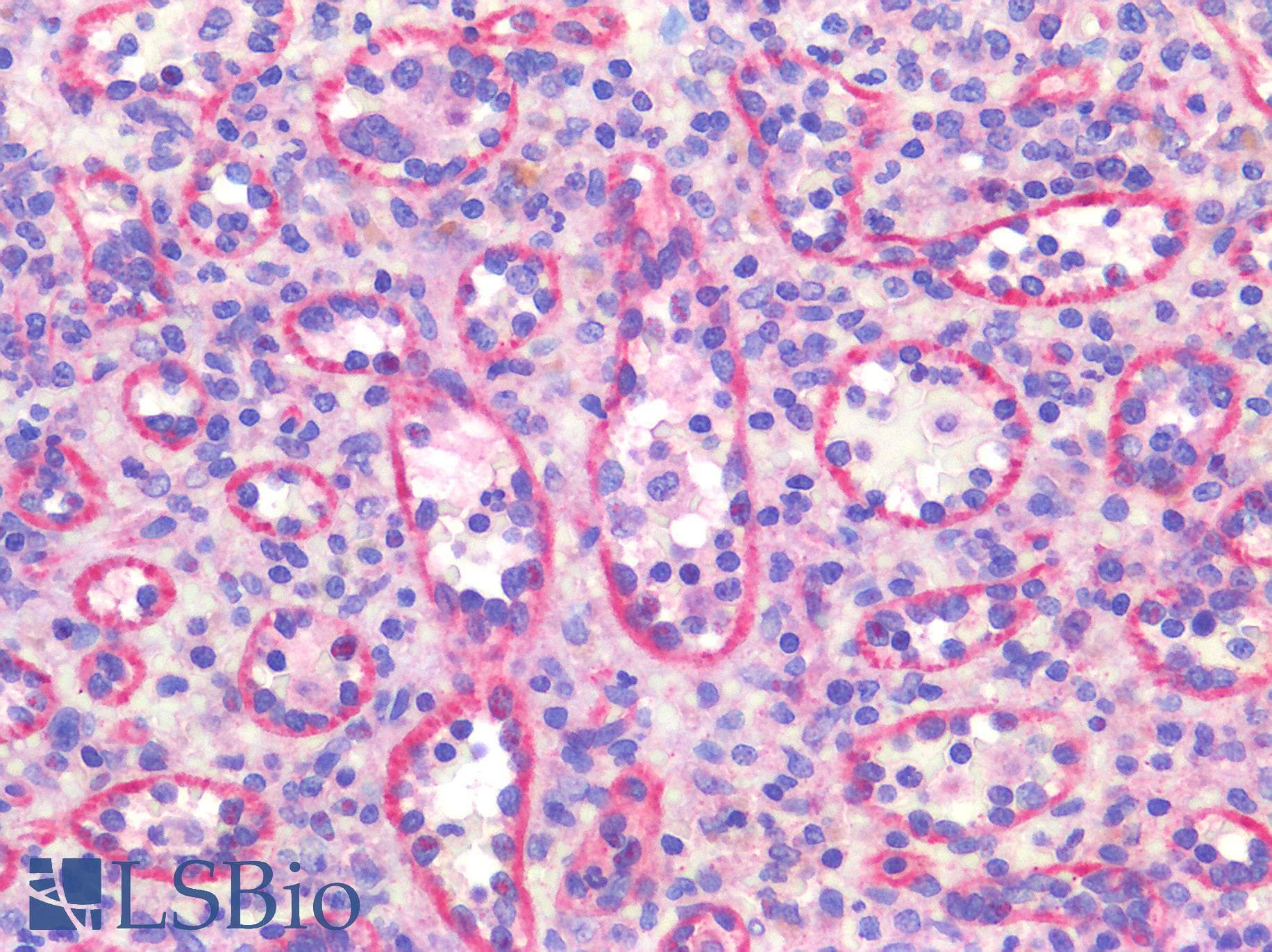 IHC-plus™ Polyclonal Rabbit anti-Human ST14 / Matriptase Antibody (aa10-59, IHC, IF, WB)