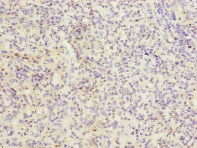 ITGAL / CD11a Antibody