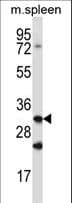Ctsq / Cathepsin Q Antibody (aa192-221)