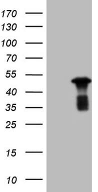 RB1 / Retinoblastoma / RB Antibody (aa309-590, clone OTI1B1)