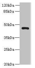 Polyclonal Rabbit anti-Human VAT1L Antibody (IHC, WB)