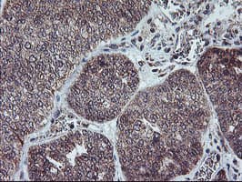 Monoclonal Mouse anti-Human PPP1R15A / GADD34 Antibody (clone OTI4F1, IHC, IF, WB)