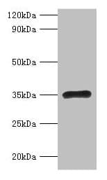 IHC-plus™ RPL5 / Ribosomal Protein L5 Antibody