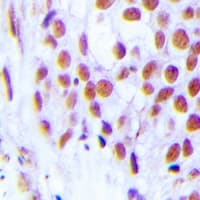 ZFPM2 / FOG2 Antibody (Internal)
