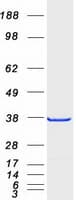 Human PHAP III / ANP32E Protein (Recombinant Myc-DDK (Flag))