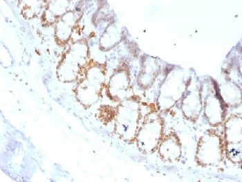 FOXA1 Antibody (clone FOXA1/1519)
