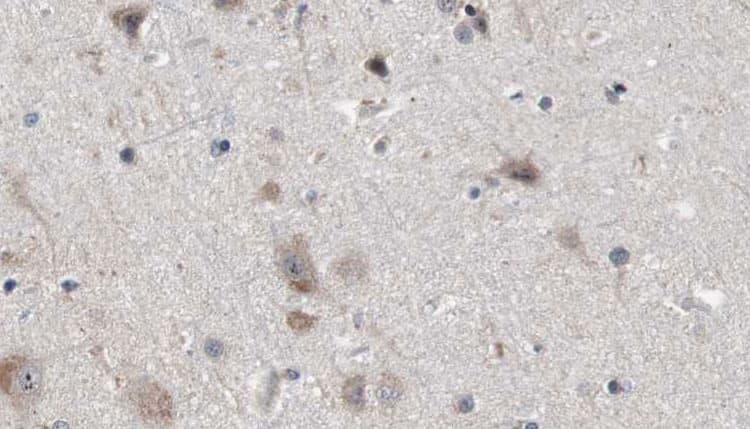 NDE1 Antibody