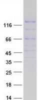 Human PZP Protein (Recombinant Myc-DDK (Flag))