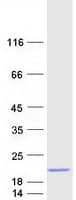 Human C20orf85 Protein (Recombinant Myc-DDK (Flag))