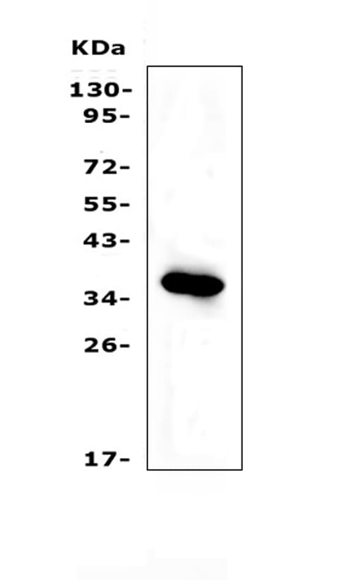 IGFBP2 / IGF-BP53 Antibody