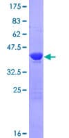 Human TSEN15 Protein (Recombinant GST)