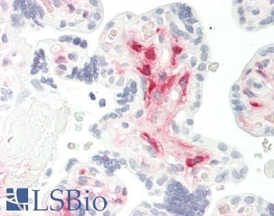 IHC-plus™ ALDH1L2 Antibody (aa743-772)