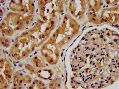 Polyclonal Rabbit anti-Human PSAT1 Antibody (IHC, IF)
