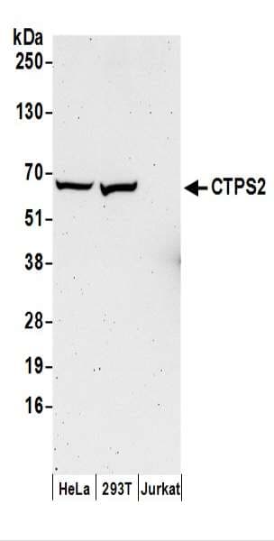 CTP Synthetase 2 / CTPS2 Antibody (aa536-586)