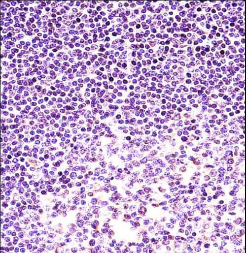 H2AFX / H2AX Antibody (aa111-140)