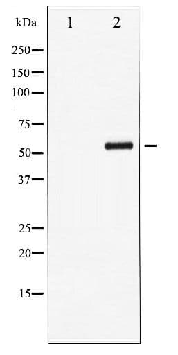MEF2A / MEF2 Antibody (phospho-Thr312)