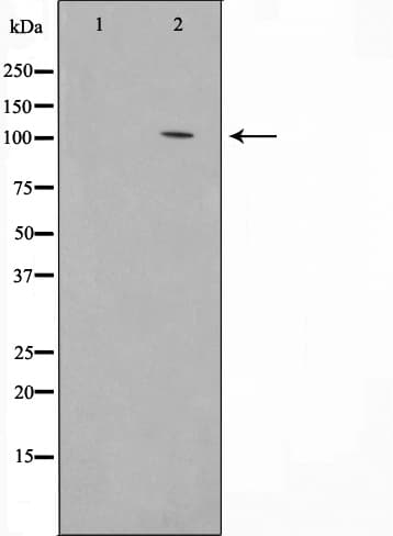 HSPH1 / HSP105 Antibody