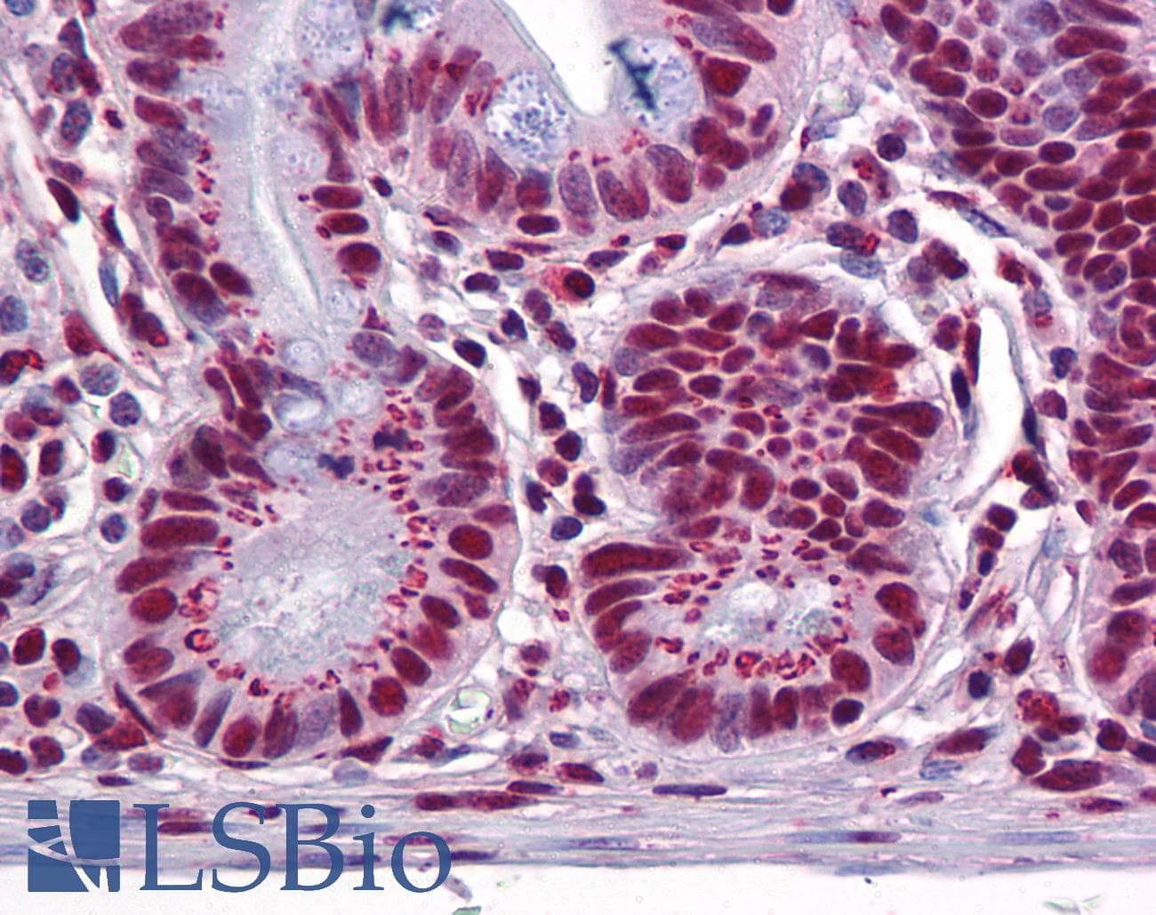 IHC-plus™ Monoclonal Mouse Polyglutamine Antibody (clone 5TF1-1C2, N-Terminus, IHC, WB)