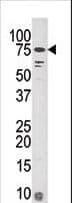 KIAA1811 / BRSK1 Antibody (aa108-139)