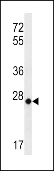 MT-CO3 / COX3 / COXIII Antibody (aa48-77)