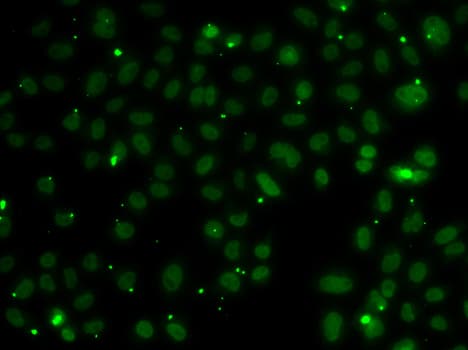 Polyclonal Rabbit anti-Human NSL1 Antibody (IHC, IF, WB)