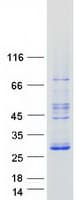 Human RRP22 / RASL10A Protein (Recombinant Myc-DDK (Flag))