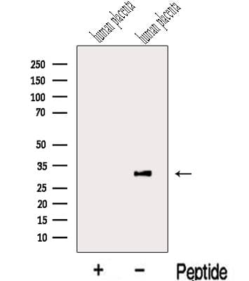 Polyclonal Rabbit anti-Human LETM2 Antibody (WB)