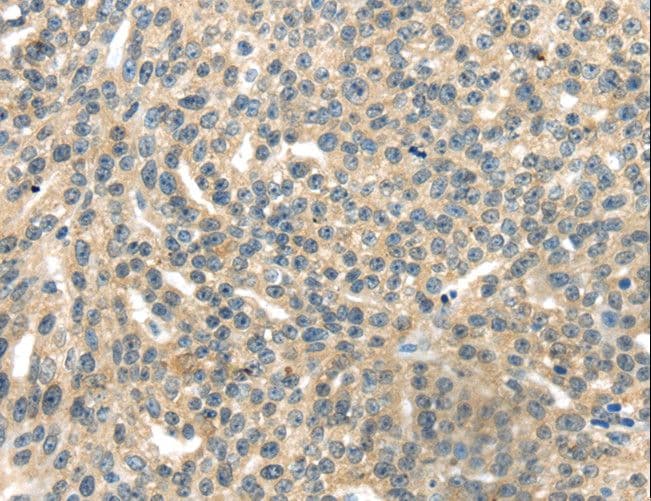 Polyclonal Rabbit anti-Human RASA2 Antibody (IHC)