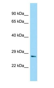 Polyclonal Rabbit anti-Human NUDT7 Antibody (aa59-108, WB)