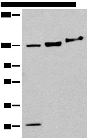 EPHA6 / EPH Receptor A6 Antibody