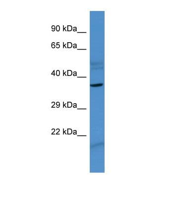 ZNF793 Antibody (N-Terminus)