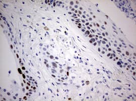p16INK4a / CDKN2A Antibody (aa25-156, clone OTI1F6)