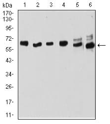 ER Alpha / Estrogen Receptor Antibody (clone 6A6F3)