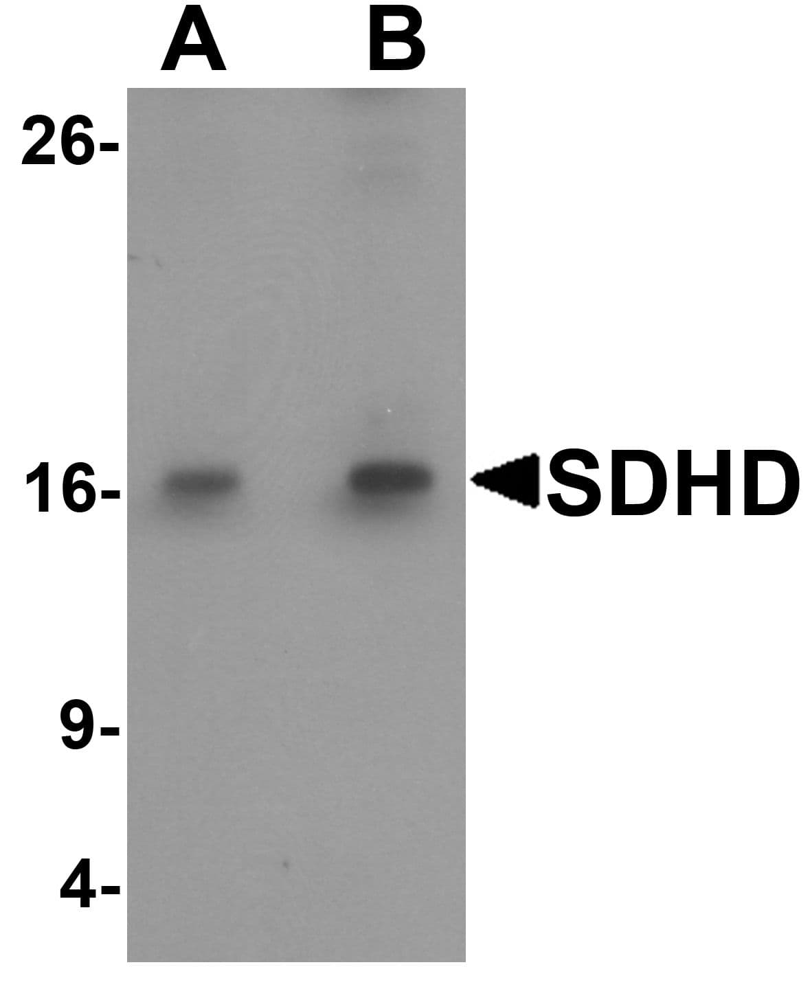 IHC-plus™ CBT1 / SDHD Antibody