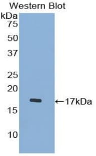 Procalcitonin Antibody (aa26-141)