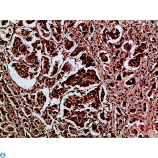 HDGF Antibody