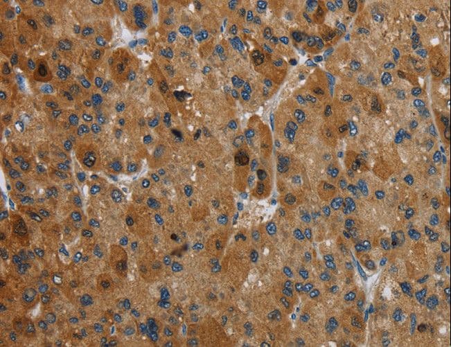 HSD17B14 Antibody