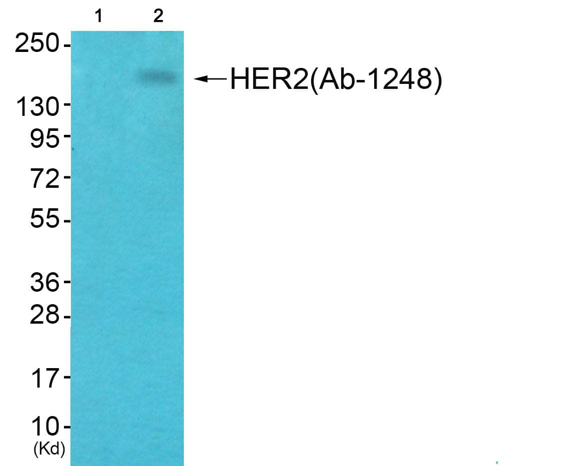 Polyclonal Rabbit anti-Human ERBB2 / HER2 Antibody (phospho-Tyr1248, IHC, WB)