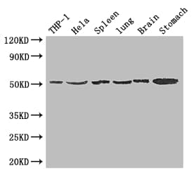 MSR1 / CD204 Antibody