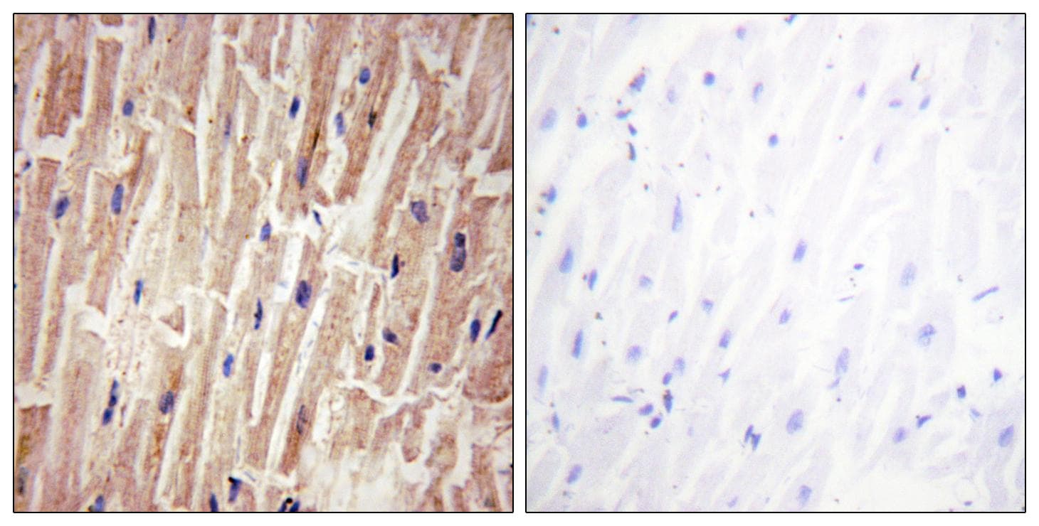 Polyclonal Rabbit anti-Human YAP / YAP1 Antibody (phospho-Ser127, IHC, WB)