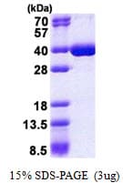 Human HNRNPK / hnRNP K Protein (Recombinant His)