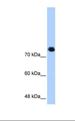 SMC3 / HCAP Antibody (aa1051-1100)