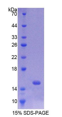 Rat BBC3 / PUMA Protein (Recombinant His-T7)
