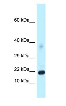 DKK4 Antibody (aa147-196)