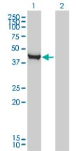 CTH / Cystathionase Antibody (clone S51)